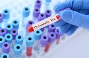 Revolutionary Gene-Editing Therapy for Beta Thalassaemia Set to Launch on NHS